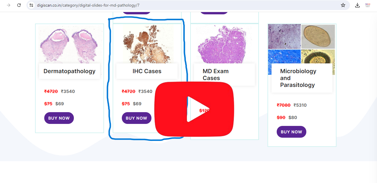 Watch Immunohistochemistry Digital Slides Set (IHC Markers & Cases)
